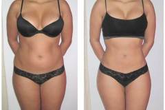 thumbs_Before-After-Abs-Pic