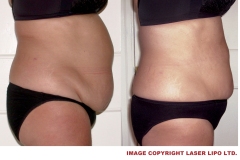 thumbs_FEMALE-STOMACH-INCH-LOSS-12
