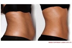 thumbs_FEMALE-STOMACH-INCH-LOSS-2